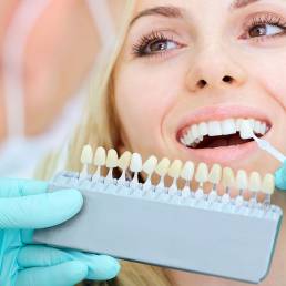 Closeup of a girl smiling at the dentist. Looking at getting her teeth whitened or veneers, making a colour selection.